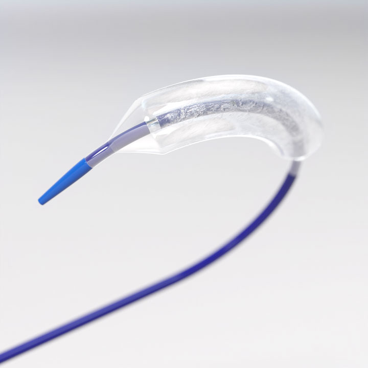 Balloon Catheter Solutions